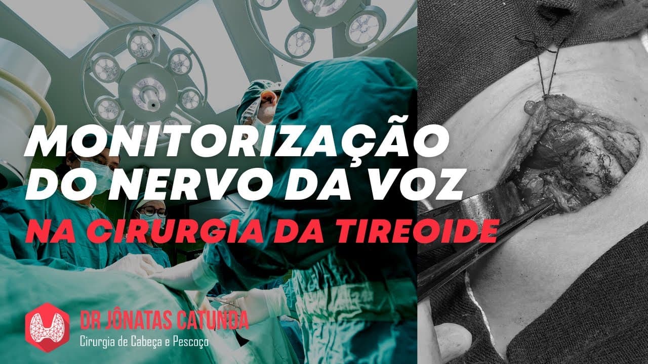 Monitorização do nervo da voz na tireoidectomia - evita rouquidão?
