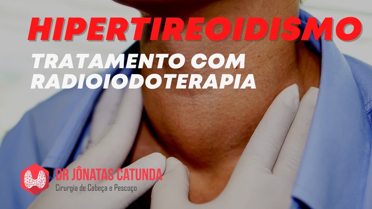 Hipertireoidismo - quando precisa fazer radioiodoterapia?