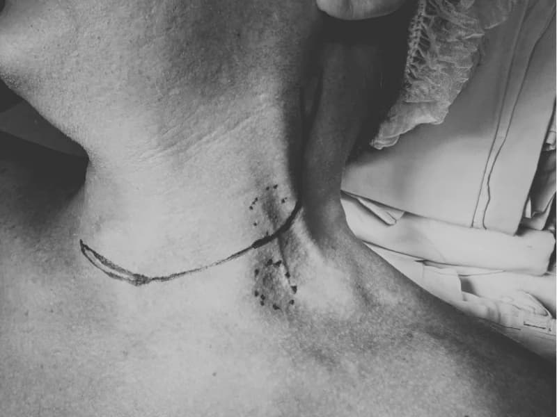 Cirurgia de Paratireoide: Quando Operar e Recuperação | Guia 2026