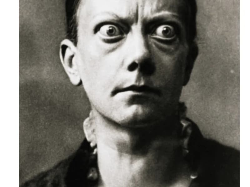 Sintomas Doenças da Tireoide: Funcionais vs Estruturais | Guia 2026