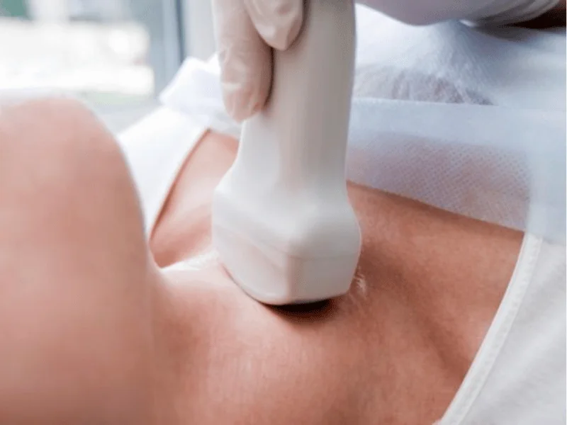 Exames de Tireoide Completos: TSH, T4, Anticorpos, Ultrassom | Guia 2026