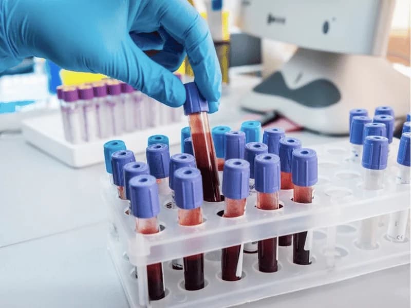 Exames de Tireoide: TSH, T4 e Anticorpos | Guia 2026