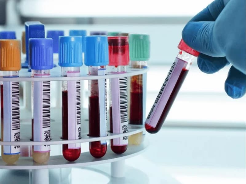 A Cirurgia Removeu Tudo — Mas um Exame de Sangue Dizia o Contrário