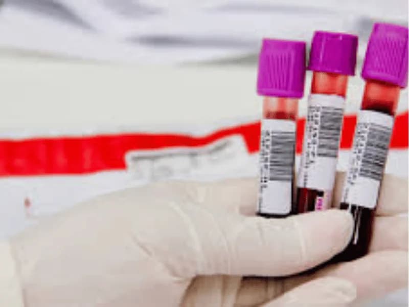 Exames da Tireoide: TSH, T4, T3, Anticorpos e Ultrassom | Guia 2026