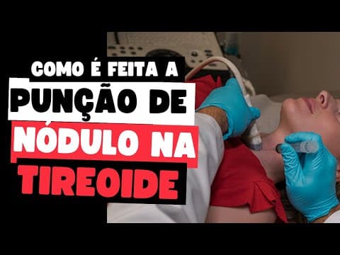 Como é feita a PAAF: entenda o procedimento e a importância para diagnóstico da tireoide