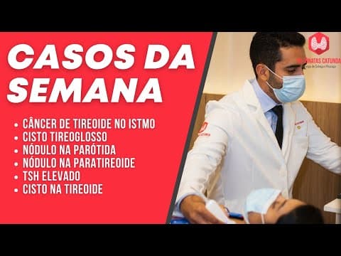 Casos da semana - Câncer de tireoide no istmo, cisto tireoglosso, Adenoma pleomórfico, TSH elevado