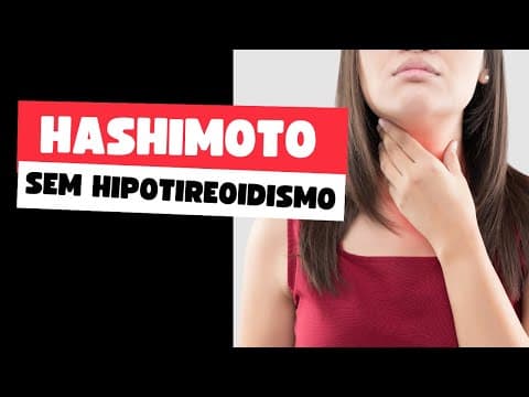 Tireoidite de Hashimoto sem hipotireoidismo - o que fazer?