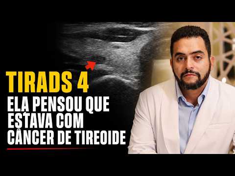 Nódulo TIRADS 4 na tireoide é câncer? O que o laudo não diz