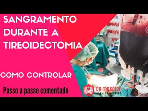 Sangramento durante a tireoidectomia - controlando hemorragias - Cirurgia | Dr Jônatas Catunda