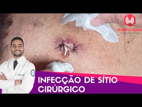 Infecção de cirurgia - Caso clínico