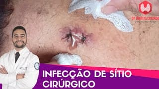 Infecção de cirurgia - Caso clínico