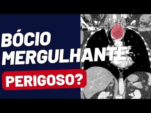 Bócio mergulhante: como identificar e quando operar
