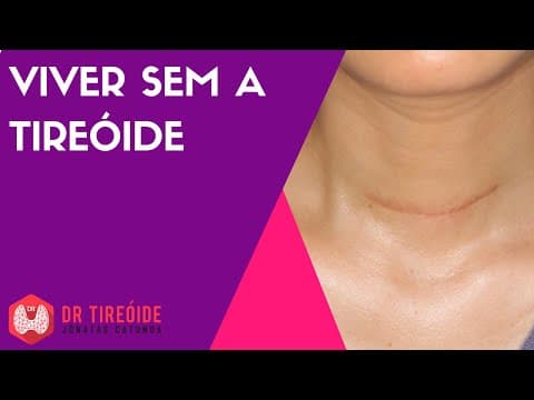 Viver sem a tireóide