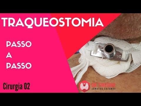 Traqueostomia - Cirurgia Passo a passo | Dr Jônatas Catunda
