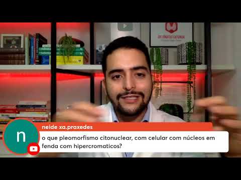 Câncer de tireoide - Respondendo perguntas ao vivo!