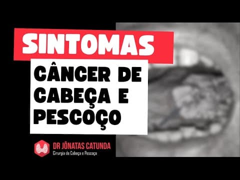 Sintomas do câncer de cabeça e pescoço