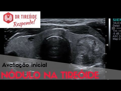 Avaliação inicial do nódulo na tireóide - Dr Tireóide Responde