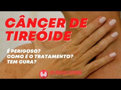 Câncer de tireóide - é perigoso? como é o tratamento? tem cura?