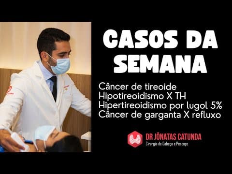 Casos da semana - Câncer de tireoide, cansaço por hipotireoidismo? hipertireoidismo