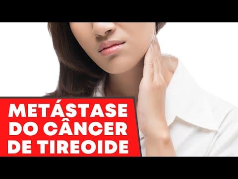 Como avaliar uma possível metástase do câncer de tireoide - Ultrassom, punção, tireoglobulina