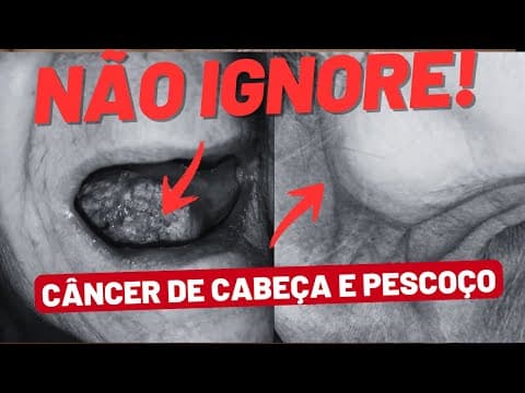 5 Sinais de Alerta no Pescoço e na Boca que Você NÃO Pode Ignorar!
