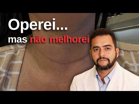 Por que algumas pessoas pioram após a cirurgia de tireoide