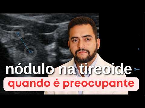 Descobriu um nódulo na tireoide? Quais fatores utilizo para decidir se deve acompanhar ou operar?