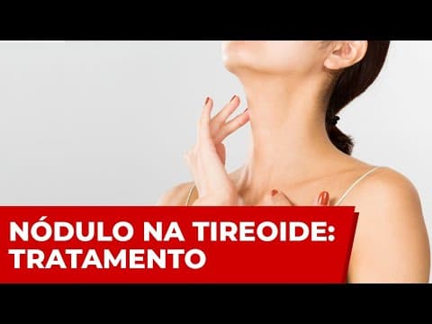 Tratamento do nódulo na tireoide - Cirurgia? Medicamentos? Acompanhar de quanto em quanto tempo?