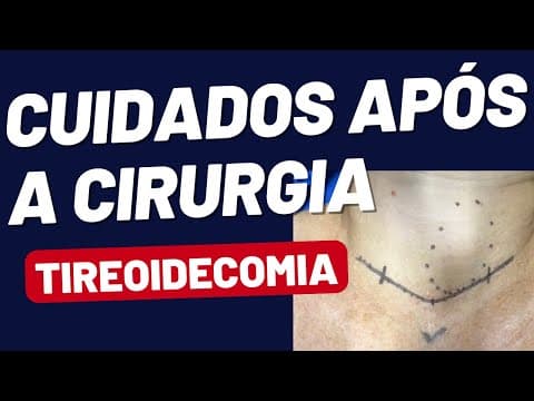 Cirurgia de Tireoide: Os Principais Cuidados para uma Recuperação Segura