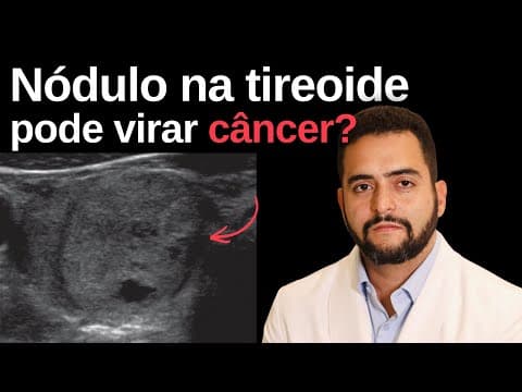 Nódulo na tireoide pode virar câncer?