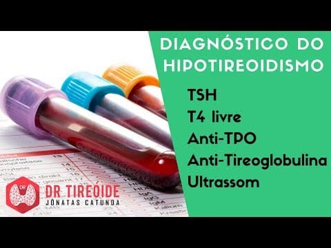 Diagnóstico do Hipotireoidismo - TSH alto? T4 livre baixo? | Dr Jônatas Catunda