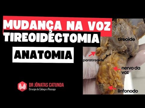 Cirurgia da tireoide pode causar alteração na voz, rouquidão, perder a voz?