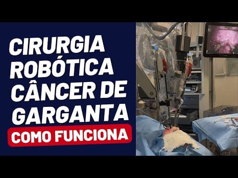 TRATAMENTO NOVO para o Câncer de GARGANTA - TORS - Cirurgia Robótica Transoral