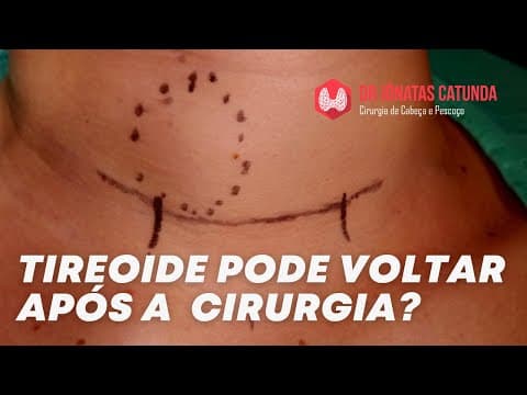Tireóide pode voltar após a cirurgia?
