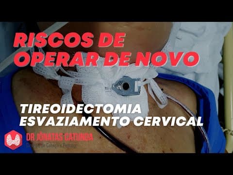 Quais os riscos quando precisa operar de novo o câncer de tireoide? Esvaziamento cervical
