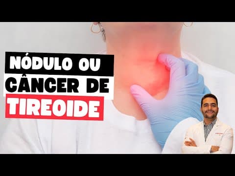 Risco do nódulo de tireoide ser um câncer de tireoide: o que você precisa saber