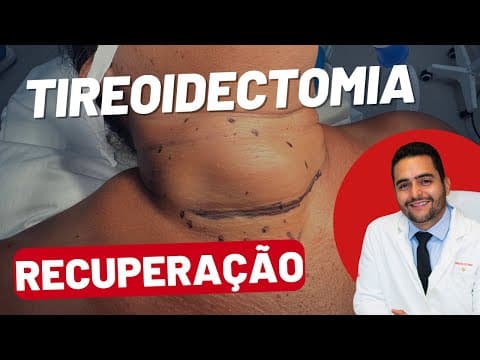 Tireoidectomia: O que Esperar Antes, Durante e Após a Cirurgia