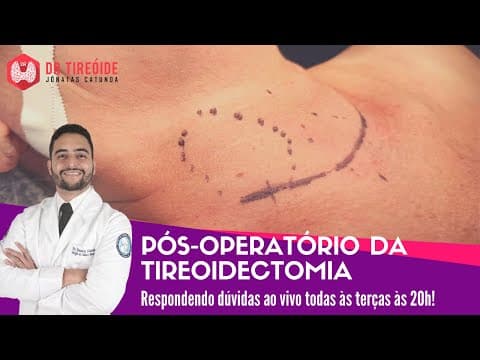 Pós-operatório da tireoidectomia total ou parcial - Dr Tireóide responde