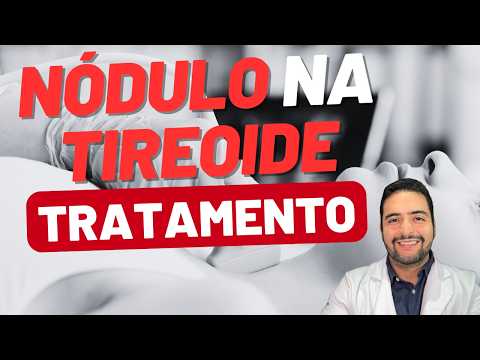 Nódulo na Tireoide: preciso me preocupar? O que fazer agora?