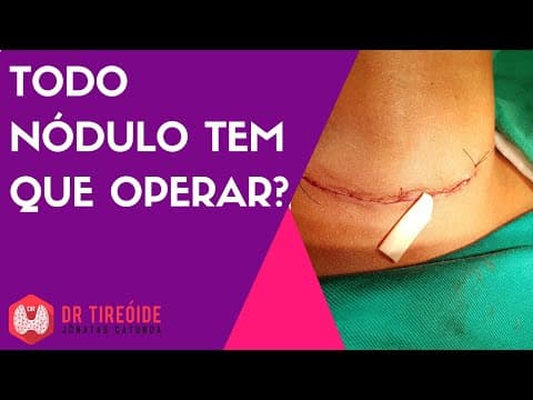 Todo nódulo da tireóide tem que operar?