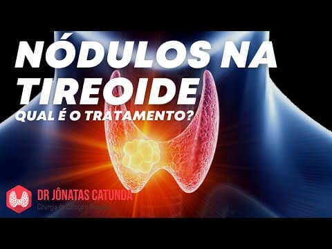 Nódulo na tireoide: existe medicamento para fazer o nódulo regredir?
