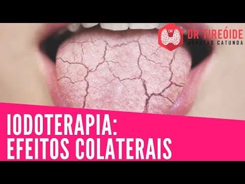 Efeitos colaterais da iodoterapia: o que é real