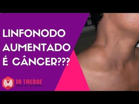 Linfonodo no pescoço é Câncer? - Dr Jônatas Catunda