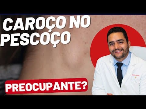 Caroço no pescoço: sinais de alerta e o que fazer