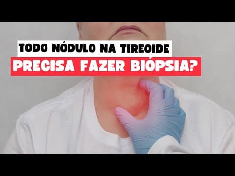 PAAF de Nódulo na Tireoide: Quando e Por Que Realizar esse Importante Exame