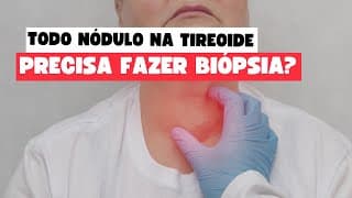 PAAF de Nódulo na Tireoide: Quando e Por Que Realizar esse Importante Exame