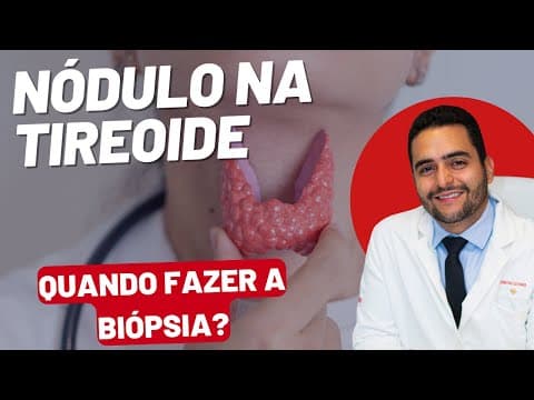 Nódulo na Tireoide: Quando Fazer a Biópsia e o que esperar