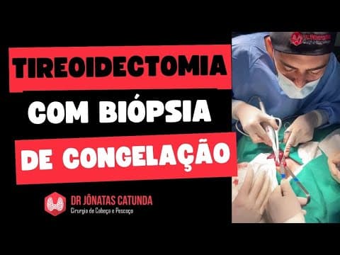 Tireoidectomia parcial com biópsia de congelação / Tireoidectomia total por Bethesda IV