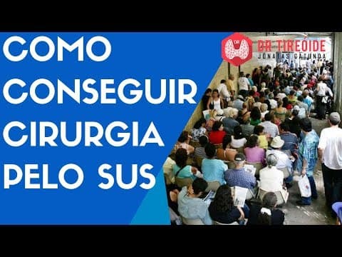 Como conseguir uma cirurgia pelo SUS - Dr Tireóide Responde