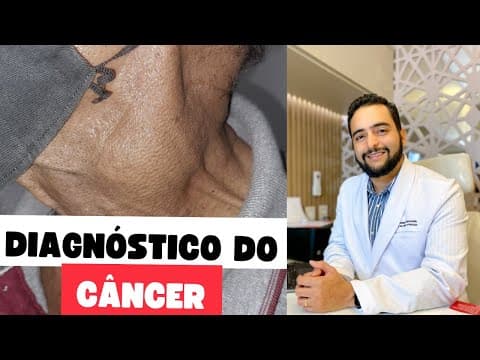 Câncer de tireoide, Câncer de laringe, sintomas do hipotireoidismo